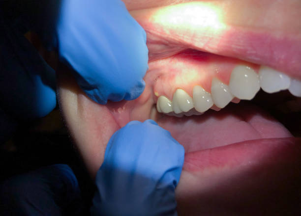 Best Emergency Treatment for Jaw Pain or Injury in Lumber City, GA