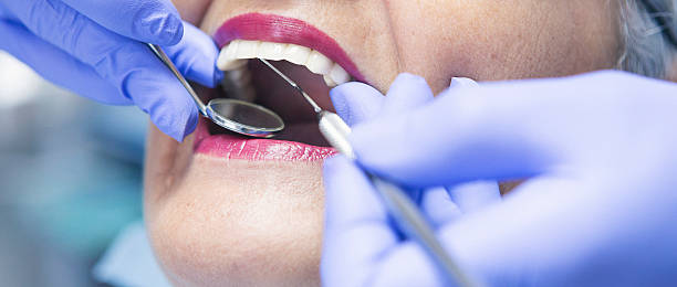 Best Emergency Treatment for Oral Infections in Lumber City, GA